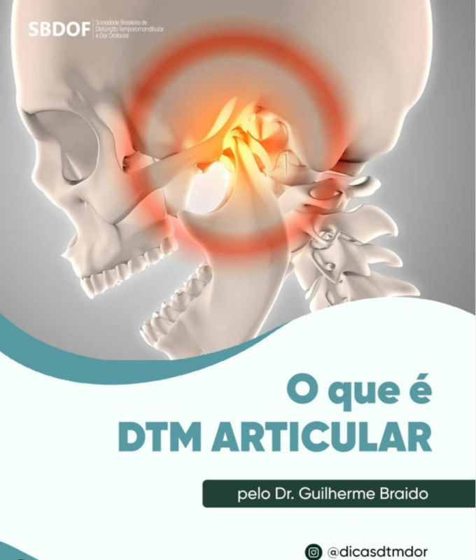 DTM e Dor Orofacial – Disfunção Temporomandibular (DTM) e Dor Orofacial