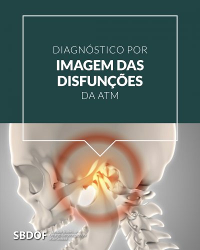 Resumo de disfunção temporomandibular: diagnóstico, tratamento e mais!